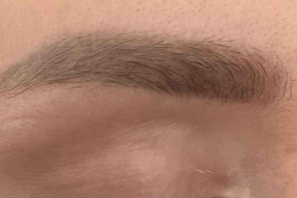 Odstranění permanentního makeupu