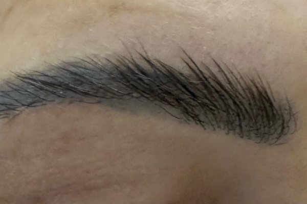Odstranění permanentního makeupu