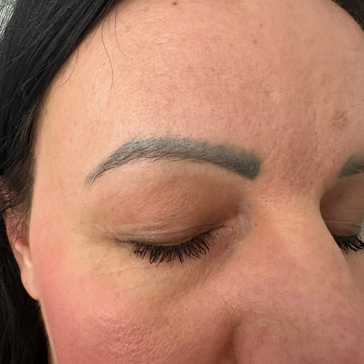 Odstranění permanentního makeupu