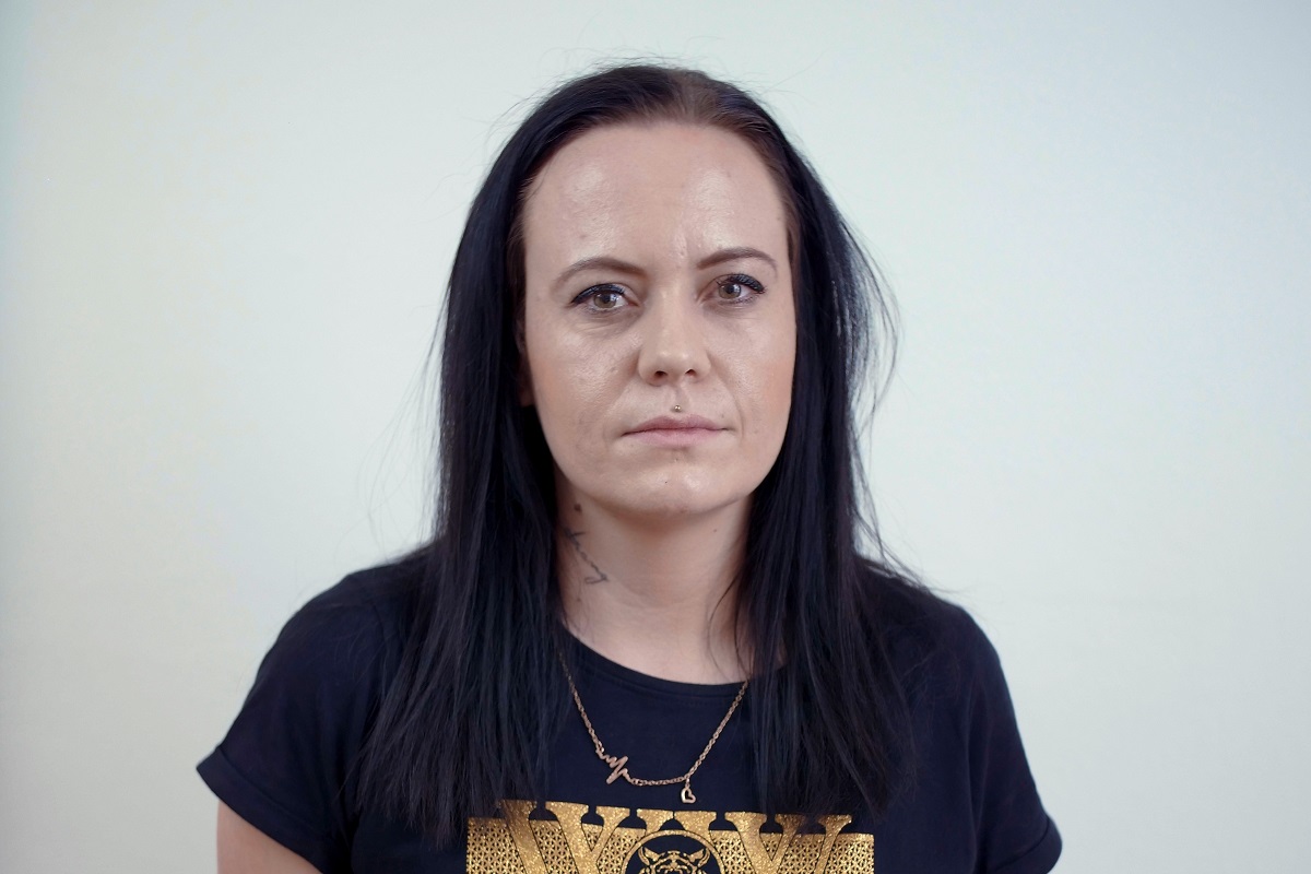 Plazmalifting - vyčištění pleti na obličeji