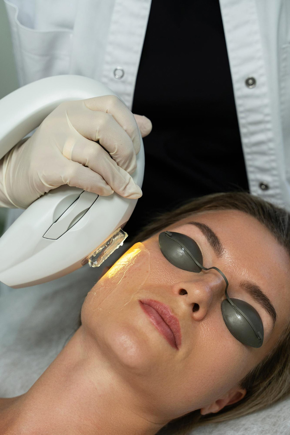 Benefity Fotorejuvenace