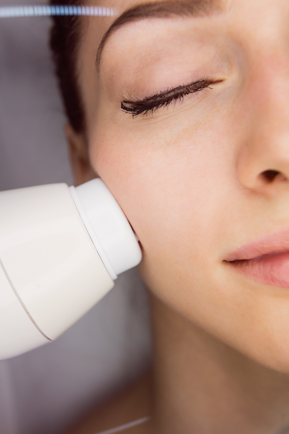 Benefits of acne treatment