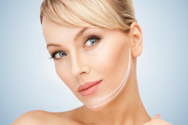 Thread lift at Petra Clinic